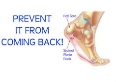 "Plantar