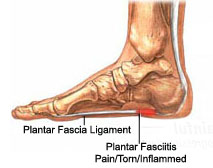 "Plantar